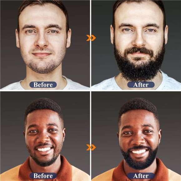 Beard Growth Kit - Beard Kit for Men W/Handmade Beard Growth Oil, Beard Balm - Picture 4 of 8